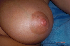 robustear16