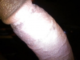 My Dick Pic