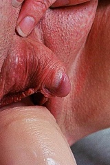 Big clit