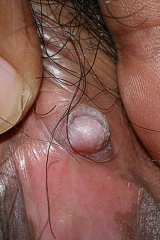Big clit
