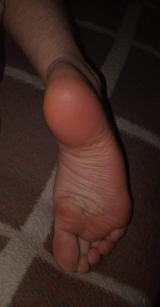 soles
