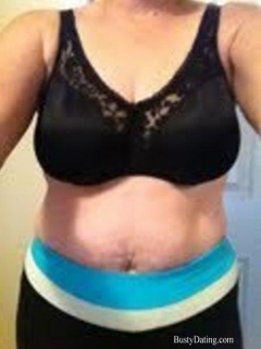 Busty Breast Reductions - Set 26 - N