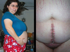 Bbwjackie - N