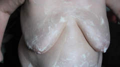 BBW Speckschwein Heike - N