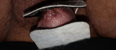Electric shock my tiny spun penis Head inflicting pain - N