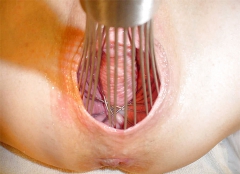 Pussy Insertion Factory II - N
