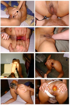 Anal Insertion Factory 1 - N