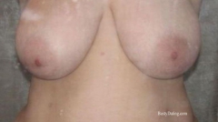 Busty Breast Reductions - Set 19 - N
