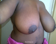Busty Breast Reductions - Set 21 - N