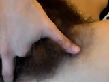 hairy teen